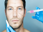 Cosmetic Surgery No Longer Taboo for Men